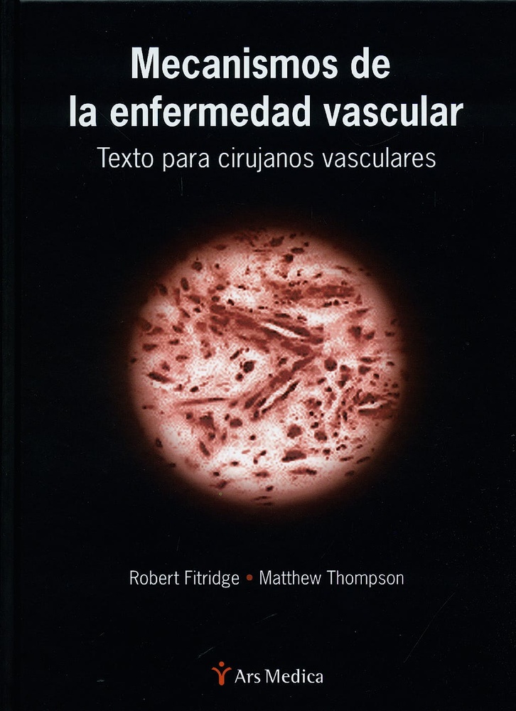 Mecanismos de la enfermedad vascular